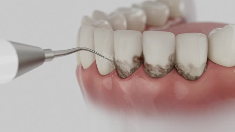 Reliable Wisdom Tooth Removal contractor in Poinsett County County, AR by Dentist Open Now